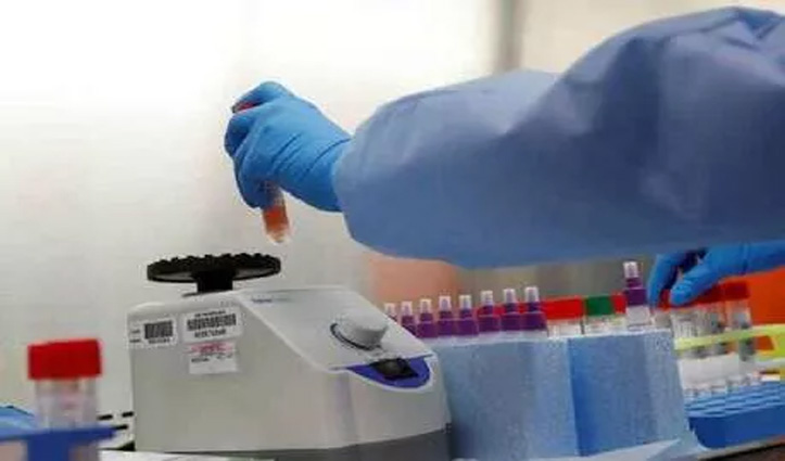 खुशखबरी : अब गाड़ी में बैठे-बैठे हो पाएगा Coronavirus का टेस्ट, ऐसे करना होगा रजिस्ट्रेशन