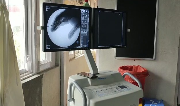ऊना अस्पताल के OT में स्थापित की सीऑर्म मशीन, अब हाईटेक तकनीक से होंगे ऑपरेशन