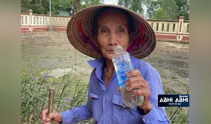 50 साल से नहीं खाया खाना! जूस-पानी के सहारे जिंदा है महिला; हादसे ने पलट दी जिंदगी